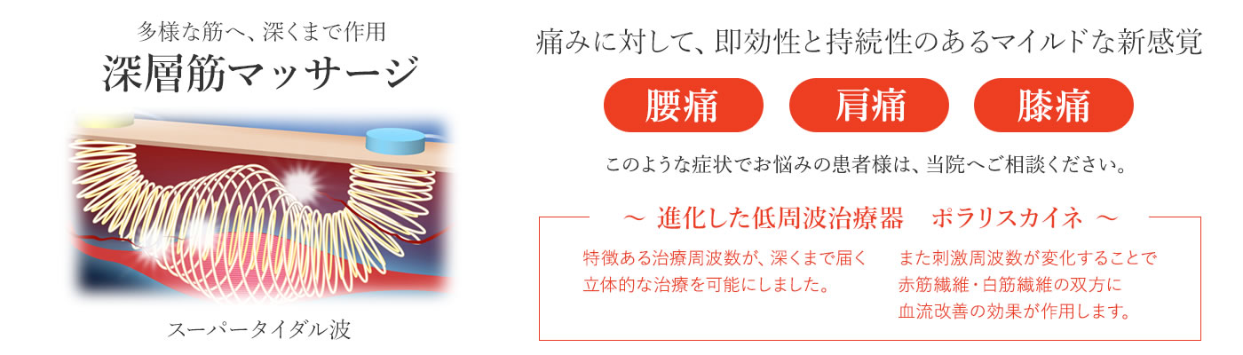 slide2